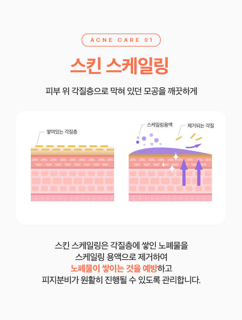 리엔장 여드름케어 스킨스케일링