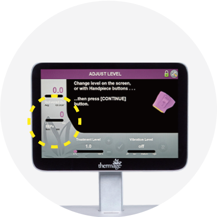 써마지 정품 정량 가이드 - 시술 후 샷수 비교 확인 모바일