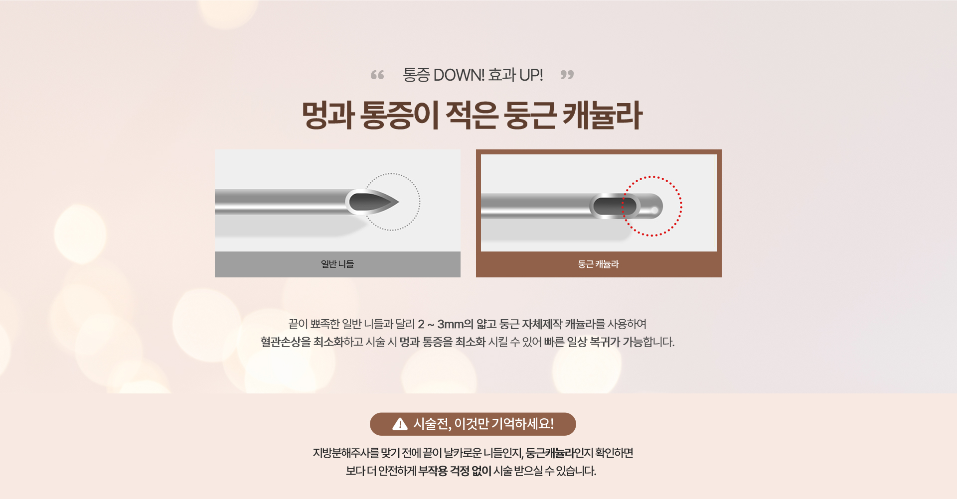 리엔장 1인치 플러스주사 캐뉼라 사용한 시술