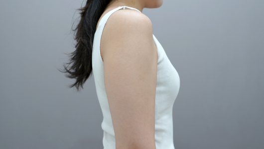 온다리프팅 바디라인 시술 전 1