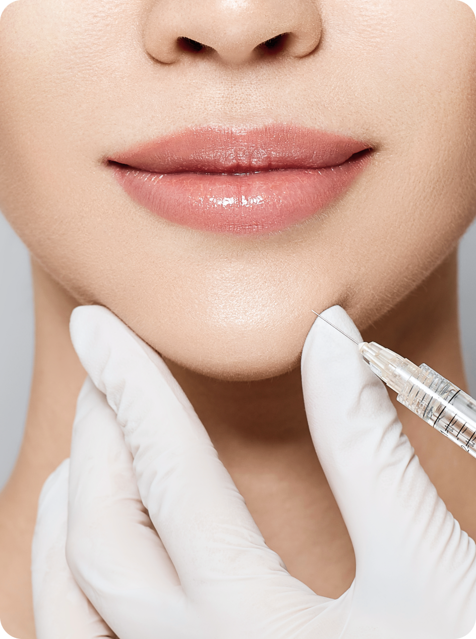 리엔장 퍼스널 필러 시술 이미지 모바일