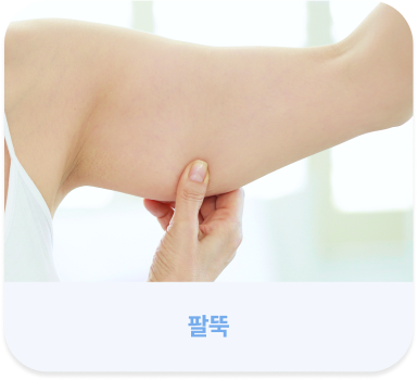 살빼주사 시술 부위 안내 이미지 팔뚝